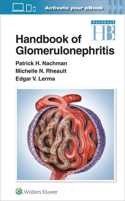 Könyv Handbook of Glomerulonephritis Patrick Nachman