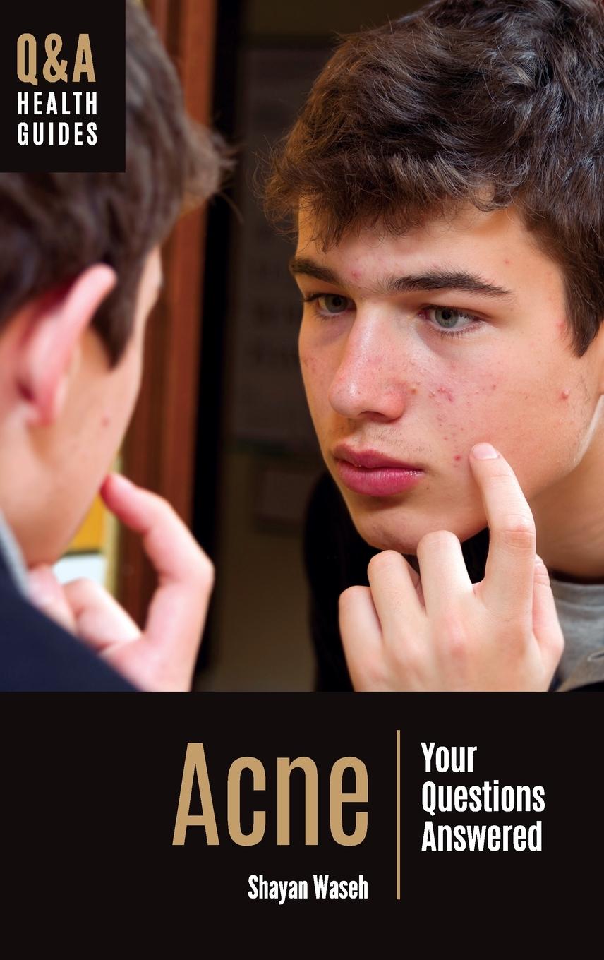 Knjiga Acne Waseh