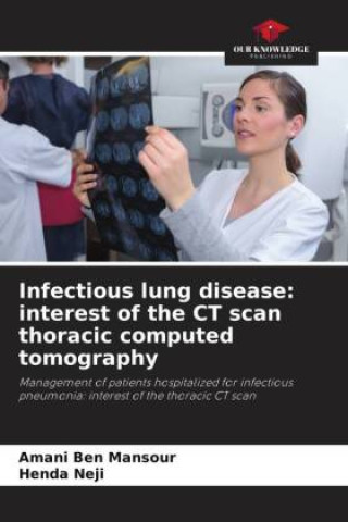 Książka Infectious lung disease: interest of the CT scan thoracic computed tomography Henda Neji