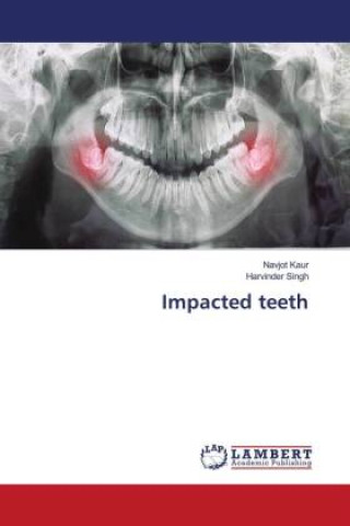 Kniha Impacted teeth Harvinder Singh