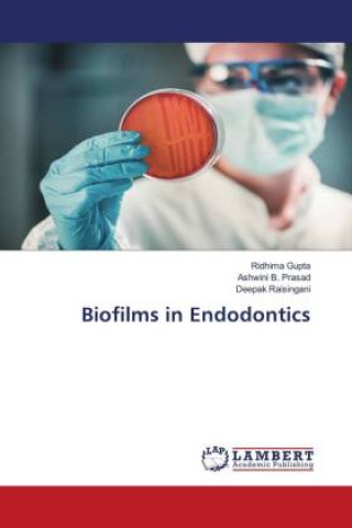 Knjiga Biofilms in Endodontics Ashwini B. Prasad