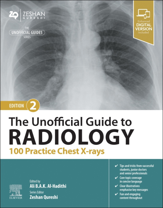 Könyv The Unofficial Guide to Radiology: 100 Practice Chest X Rays Ali Al-Hadithi
