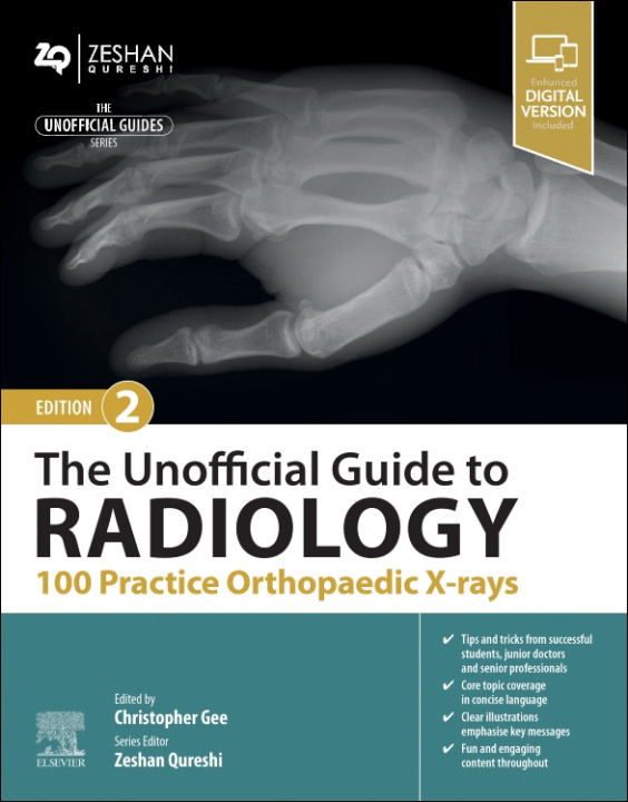 Kniha The Unofficial Guide to Radiology: 100 Practice Orthopaedic X Rays Christopher Gee