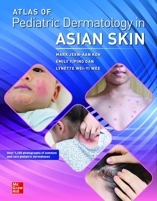 Kniha Atlas of Pediatric Dermatology in Asian Skin Emily Yiping Gan