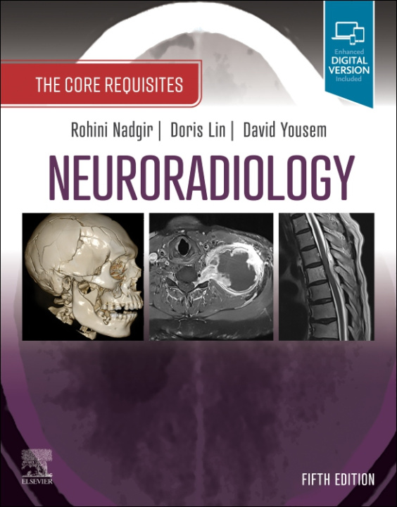 Carte Neuroradiology Rohini Nadgir