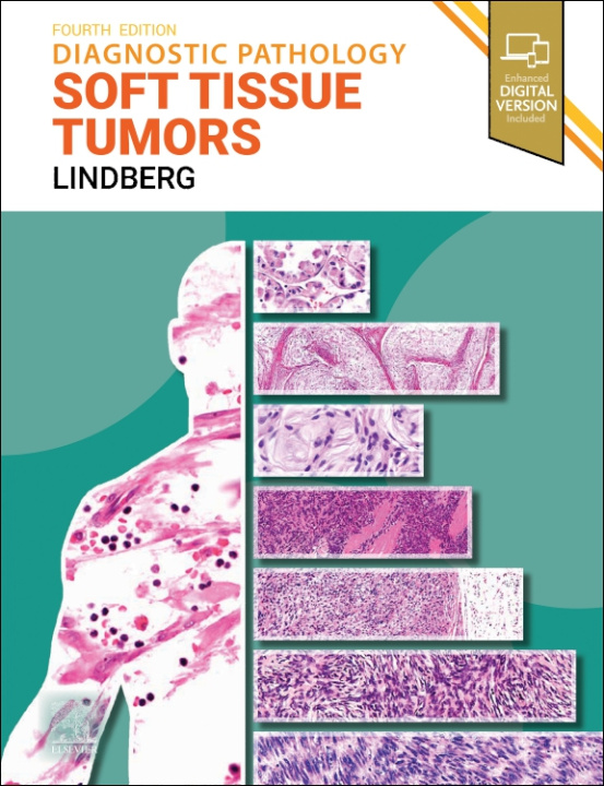 Kniha Diagnostic Pathology: Soft Tissue Tumors Matthew R. Lindberg