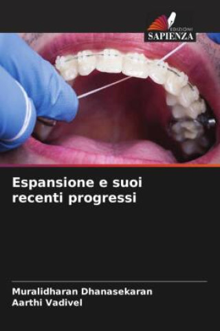 Knjiga Espansione e suoi recenti progressi Aarthi Vadivel