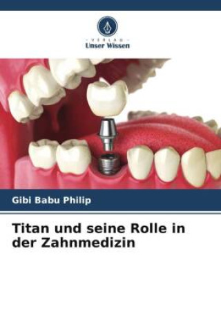 Kniha Titan und seine Rolle in der Zahnmedizin 