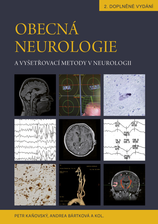 Kniha Obecná neurologie a vyšetřovací metody v neurologii Petr Kaňovský
