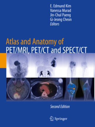Carte Atlas and Anatomy of PET/MRI, PET/CT and SPECT/CT E. Edmund Kim