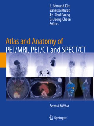 Knjiga Atlas and Anatomy of PET/MRI, PET/CT and SPECT/CT E. Edmund Kim