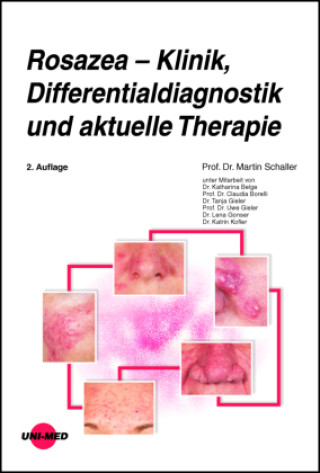 Boek Rosazea - Klinik, Differentialdiagnostik und aktuelle Therapie Martin Schaller