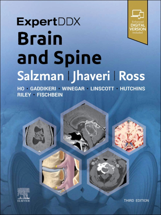 Книга ExpertDDx: Brain and Spine Karen L. Salzman
