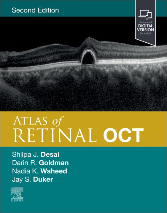 Knjiga Atlas of Retinal OCT Jay S. Duker