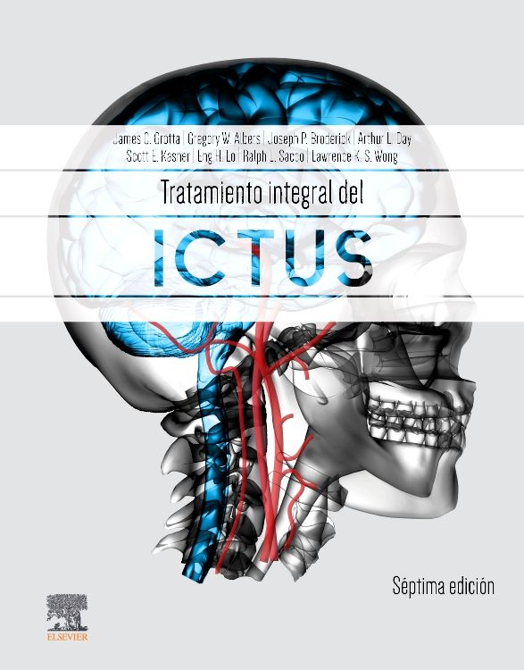 Carte Tratamiento integral del ictus 