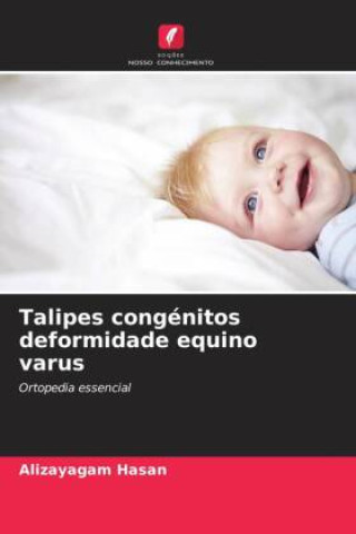Knjiga Talipes congénitos deformidade equino varus Alizayagam Hasan