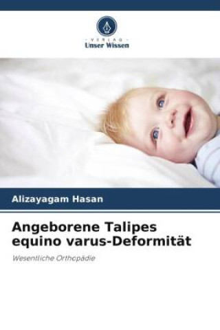 Boek Angeborene Talipes equino varus-Deformität Alizayagam Hasan