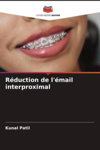Kniha Réduction de l'émail interproximal Kunal Patil