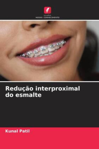 Knjiga Reduç?o interproximal do esmalte Rashmi Kunal Patil