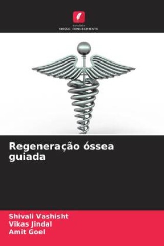 Libro Regeneração óssea guiada Shivali Vashisht