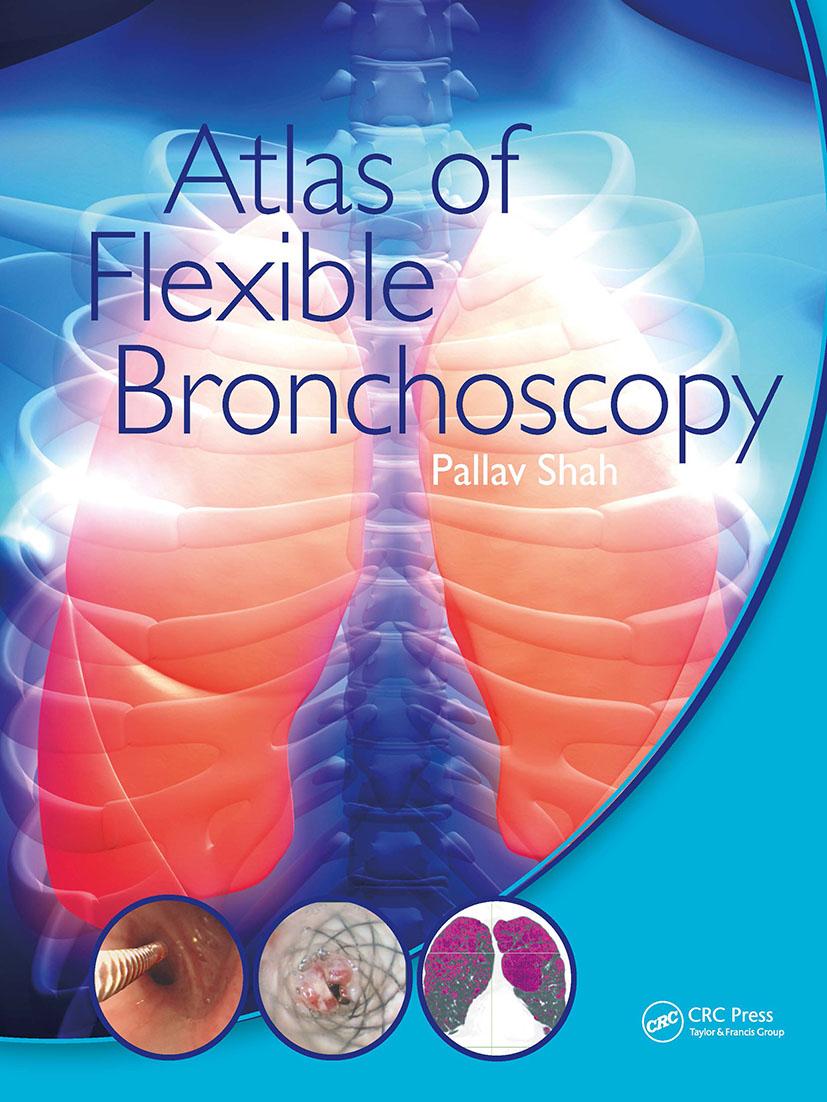 Książka Atlas of Flexible Bronchoscopy Pallav Shah
