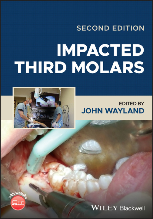 Livro Impacted Third Molars Wayland