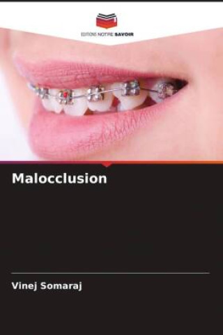 Knjiga Malocclusion Vinej Somaraj