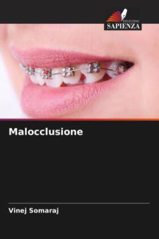 Knjiga Malocclusione Vinej Somaraj