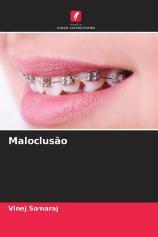 Kniha Maloclus?o Vinej Somaraj