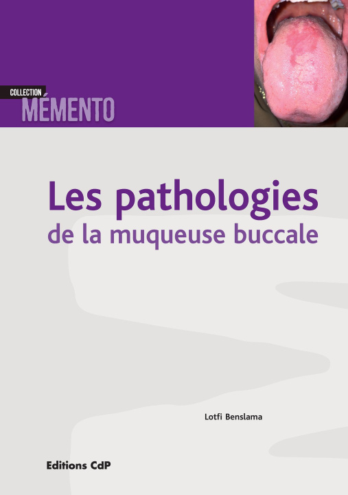 Kniha Les pathologies de la muqueuse buccale BENSLAMA