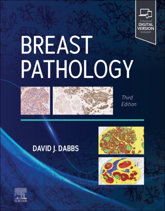 Könyv Breast Pathology David J Dabbs