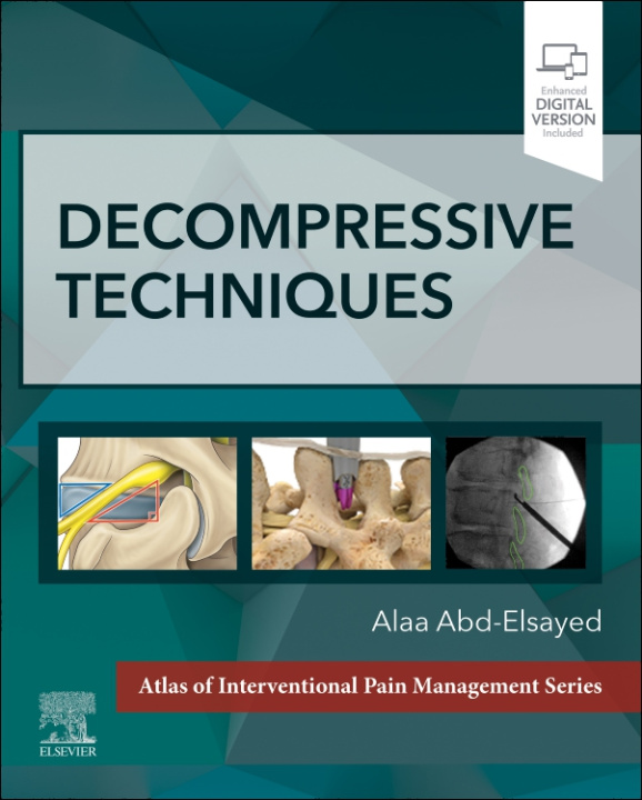 Knjiga Decompressive Techniques Alaa Abd-Elsayed