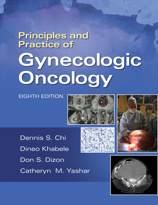 Книга Principles and Practice of Gynecologic Oncology Dennis Chi