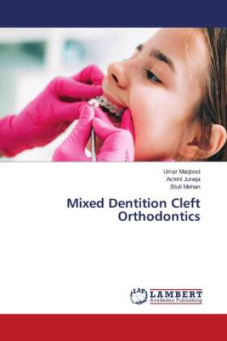 Kniha Mixed Dentition Cleft Orthodontics Achint Juneja