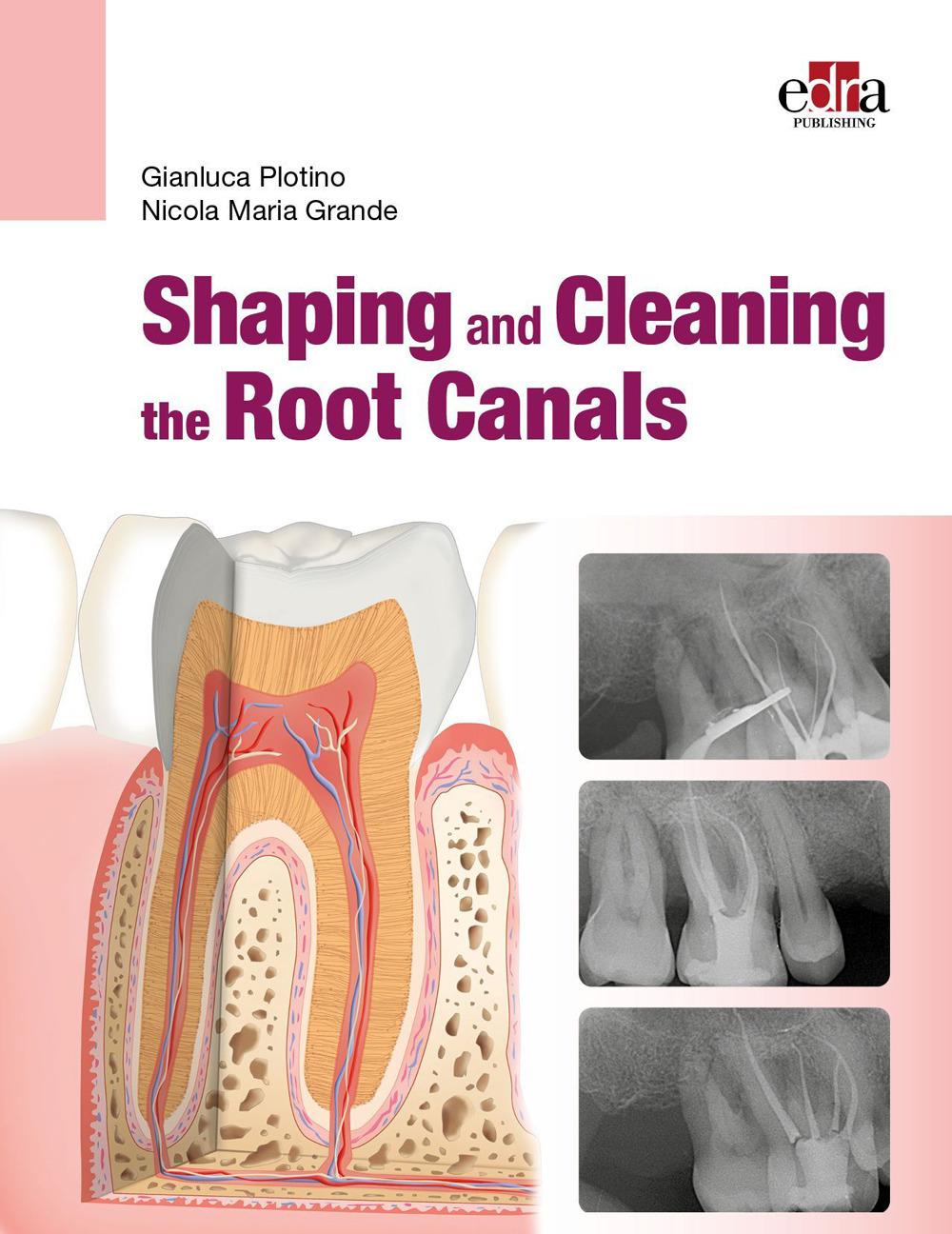 Kniha Shaping and Cleaning the Root Canals PLOTINO
