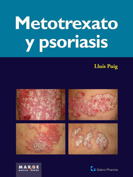 Carte Metotrexato y psoriaris 