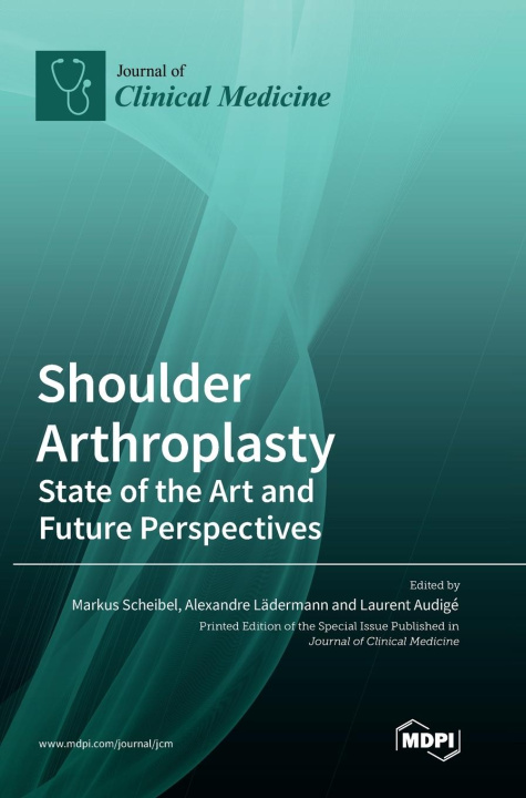 Buch Shoulder Arthroplasty Markus Scheibel