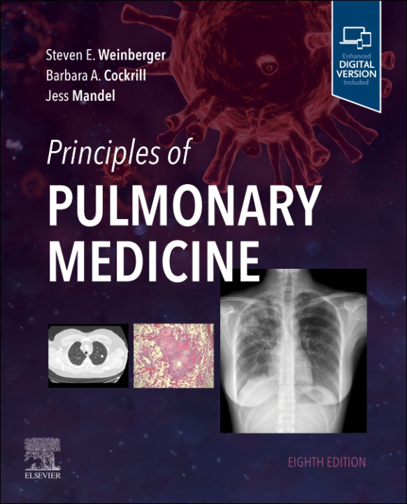 Könyv Principles of Pulmonary Medicine Steven E. Weinberger