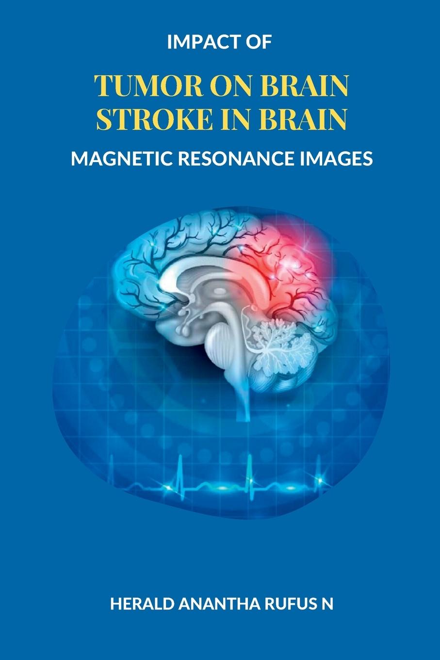 Kniha Impact of Tumor on Brain Stroke in Brain Magnetic Resonance Images 