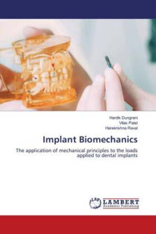 Kniha Implant Biomechanics Vilas Patel
