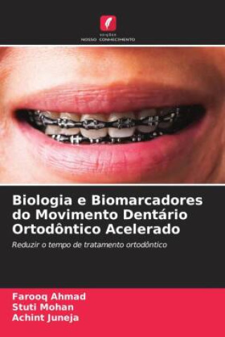 Kniha Biologia e Biomarcadores do Movimento Dentário Ortodôntico Acelerado Stuti Mohan