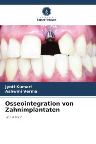 Buch Osseointegration von Zahnimplantaten Ashwini Verma