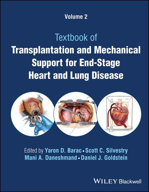 Könyv Transplantation and Mechanical Support for End-Stage Heart and Lung Disease, Volume 2 Scott C. Silvestry