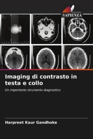 Knjiga Imaging di contrasto in testa e collo Harpreet Kaur Gandhoke
