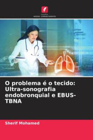 Knjiga O problema é o tecido: Ultra-sonografia endobronquial e EBUS-TBNA Sherif Mohamed