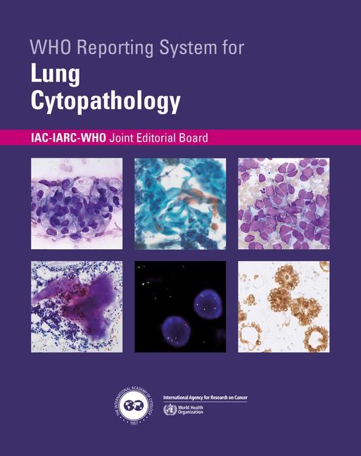 Kniha Who Reporting System for Lung Cytopathology 