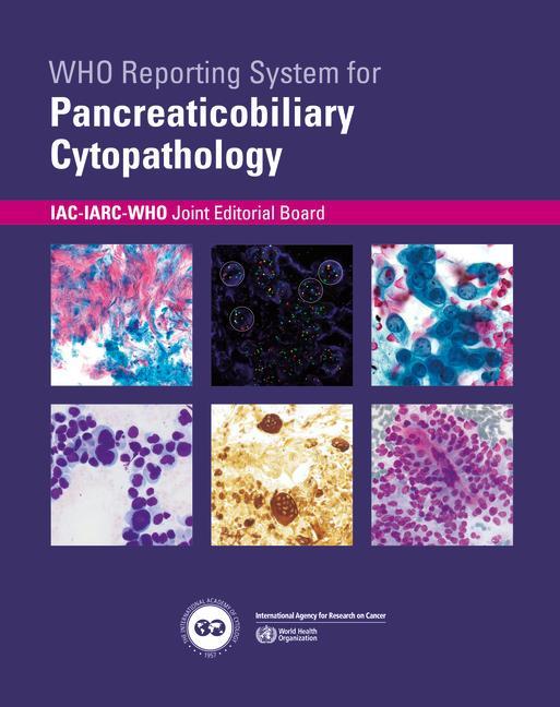 Book Who Reporting System for Pancreaticobiliary Cytopathology 