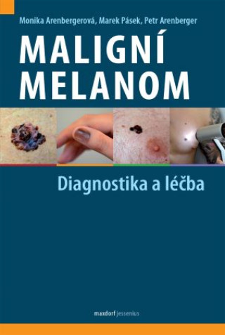 Könyv Maligní melanom - Diagnostika a léčba Monika Arenbergerová