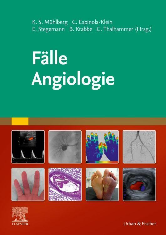 Könyv Fälle Angiologie Bernd Krabbe