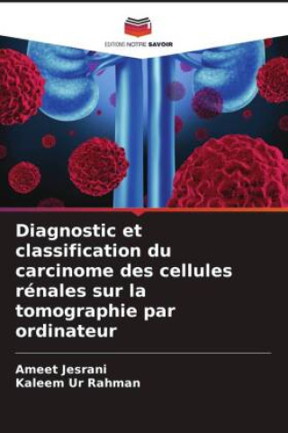 Carte Diagnostic et classification du carcinome des cellules rénales sur la tomographie par ordinateur Ameet Jesrani